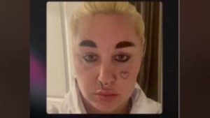 Amanda Bynes has recently raised alarms on social media after a video surfaced showing her with an old
